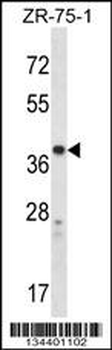 CYSLTR1 Antibody (Center)