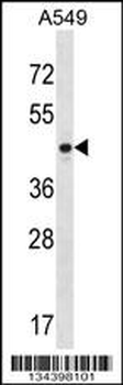 PTX3 Antibody (Center)