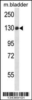 PTPN14 Antibody (C-term)