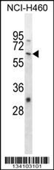WHSC2 Antibody (Center)