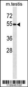 WWOX Antibody (C-term)