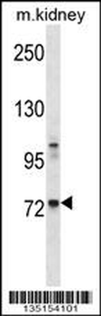 Mouse Tec Antibody (Center)