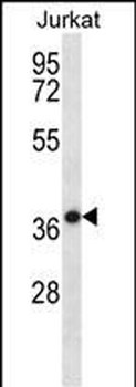 HSPBP1 Antibody (N-term)