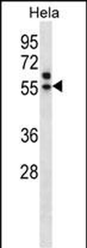 TADA3L Antibody (C-term)