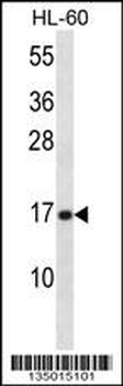 PLA2G5 Antibody (C-term)