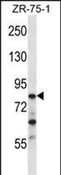 CNOT3 Antibody (N-term)