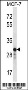 GRAP2 Antibody (Center)