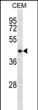 NDRG2 Antibody (N-term)