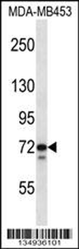TMPO Antibody (N-term)