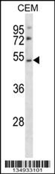 P2RY2 Antibody (C-term)