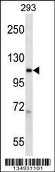 POLR2B Antibody (Center)