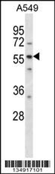LSM14A Antibody (C-term)