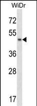ANKS4B Antibody (Center)