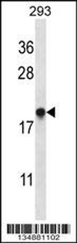 TMM85 Antibody (N-term)
