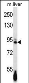 Mouse Ephb4 Antibody (Center)