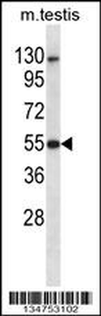 Mouse Dapk3 Antibody (Center)