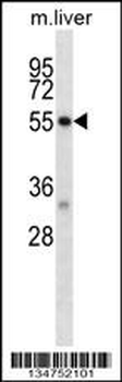 Mouse Dapk2 Antibody (N-term)
