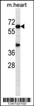 Mouse Akt1 Antibody (N-term)