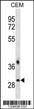 TRA2B Antibody (Center)