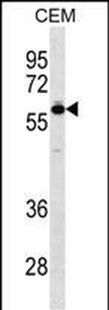 TBX5 Antibody (N-term)