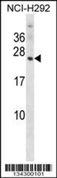 OMP Antibody (N-term)