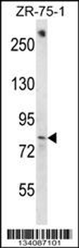 BACH1 Antibody (C-term)