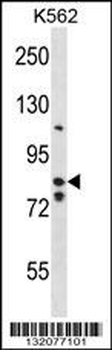 BACH2 Antibody (Center)