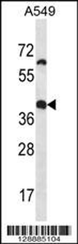 OR14J1 Antibody (C-term)