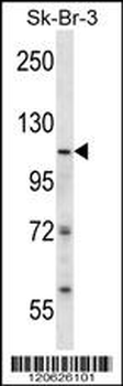 ISWI Antibody (N-term)