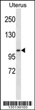 Mouse Ksr2 Antibody (C-term)