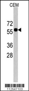 CNOT4 Antibody (C-term)
