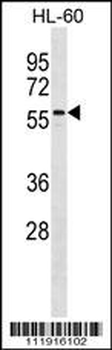 CNOT4 Antibody (N-term)