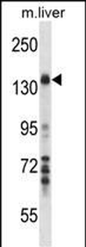 Mouse Map3k1 Antibody (C-term)