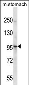 Mouse Epha1 Antibody (Center)
