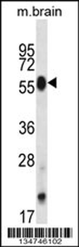 Mouse Clk4 Antibody (N-term)