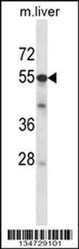 Mouse Adck2 Antibody (Center)