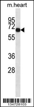 Mouse Adck1 Antibody (C-term)
