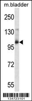 Mouse Aak1 Antibody (Center)