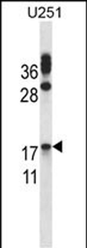 CGB/hCG-Beta Antibody (Center)