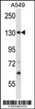 PSMD1 Antibody (N-term)