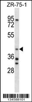 AIP Antibody (C-term)
