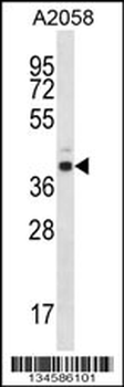 E2F3 Antibody (Center)