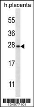 SNAP23 Antibody (C-term)