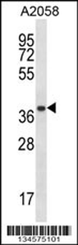 PSMA1 Antibody (C-term)