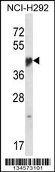 NR1I3 Antibody (Center)