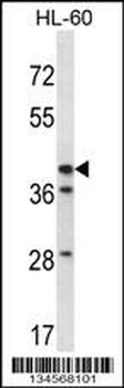 HSD3B1 Antibody (N-term)