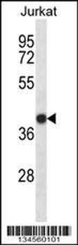 SET Antibody (N-term)