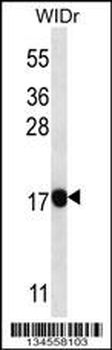 PAEP Antibody (Center)