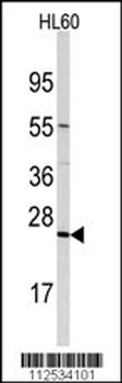 TRAPPC4 Antibody (N-term)