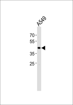 TGIF1 Antibody (N-term)